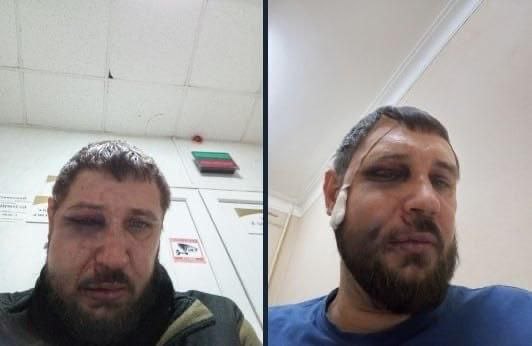 Обложка статьи В Екатеринбурге неизвестные избили журналистов проекта «Прекрасная Россия»